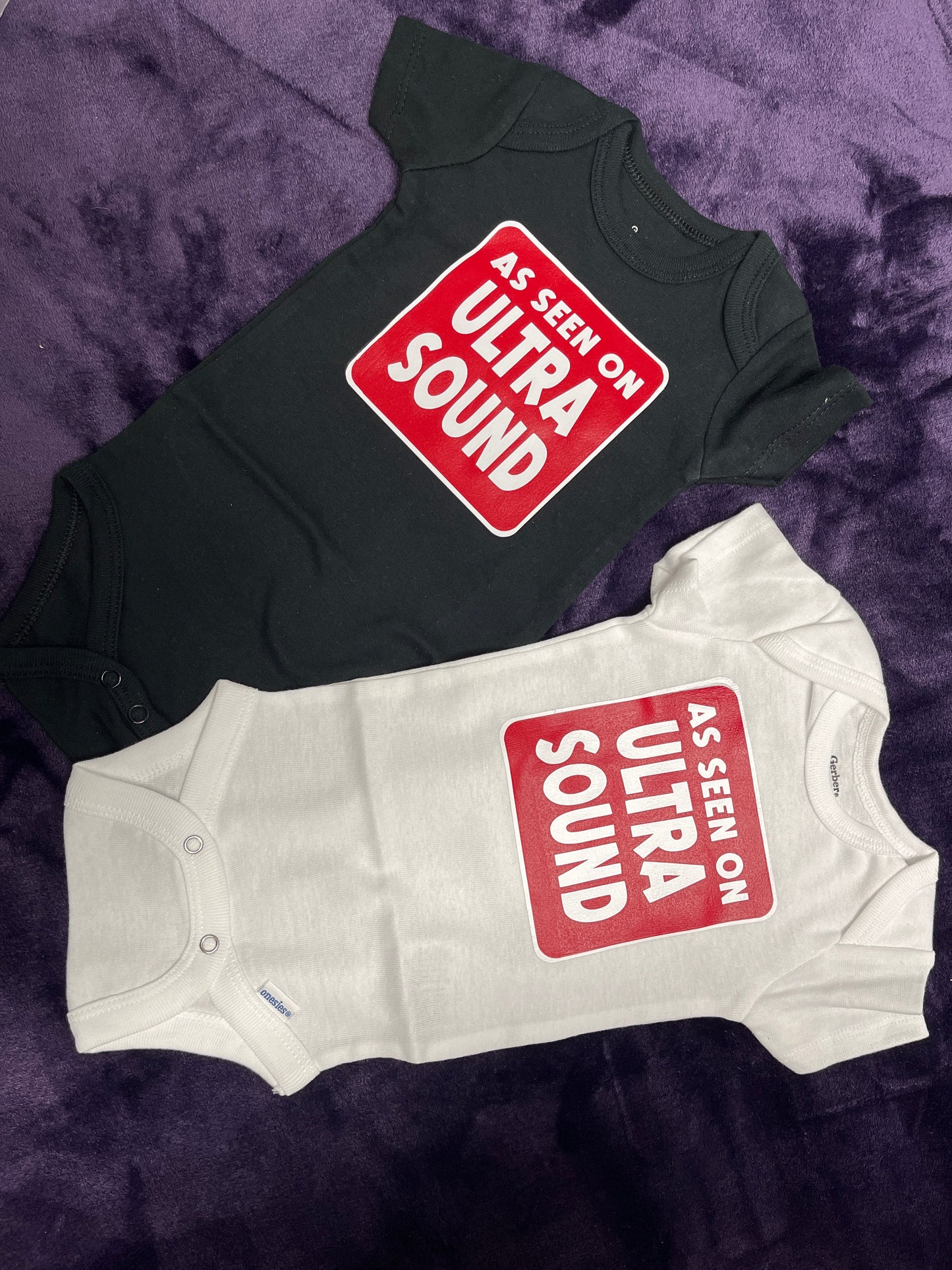 As seen on Ultrasound Onesie